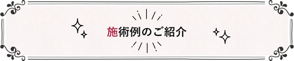 施術例のご紹介
